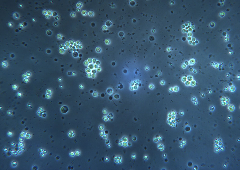0208_Chlorella_z